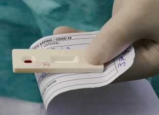 Mundo atinge mais de 8 milhões de casos confirmados de covid-19