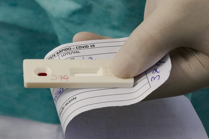 Mundo atinge mais de 8 milhões de casos confirmados de covid-19
