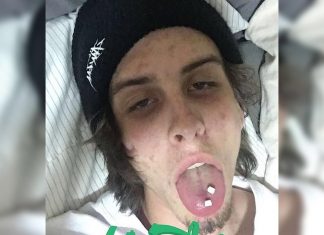 Jovem viraliza com fotos antes e depois de largar drogas: 'Finalmente vivo'