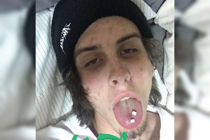 Jovem viraliza com fotos antes e depois de largar drogas: 'Finalmente vivo'