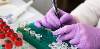 Governo entrega kits incompletos para testes de covid-19