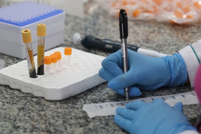 Covid-19: pesquisa testará presença de anticorpos em 211 mil pessoas