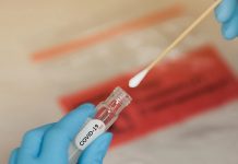 Brasil registra mais de 22 mil novos casos de covid-19 nas últimas 24h