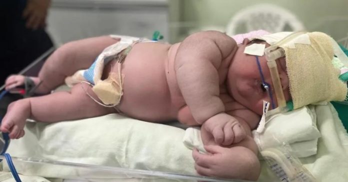 Bebê gigante nasce com mais de 7 kg em maternidade de Parintins