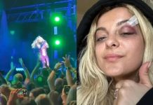 Bebe Rexha é atingida por celular durante show; veja vídeo