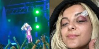 Bebe Rexha é atingida por celular durante show; veja vídeo